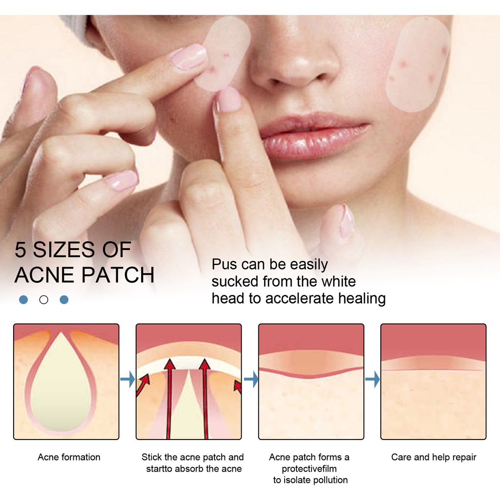 Set 80 Miếng Dán Hỗ Trợ Giảm Mụn Vô Hình Chống Thấm Nước