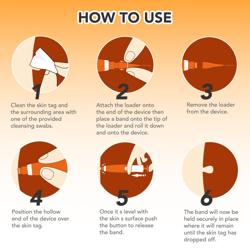 Dụng Cụ Tháo Nhãn Da Nhanh Chóng Không Đau 2-8 5Mm