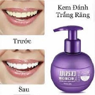 COMBO 2 Kem đánh trắng răng Baking Soda
