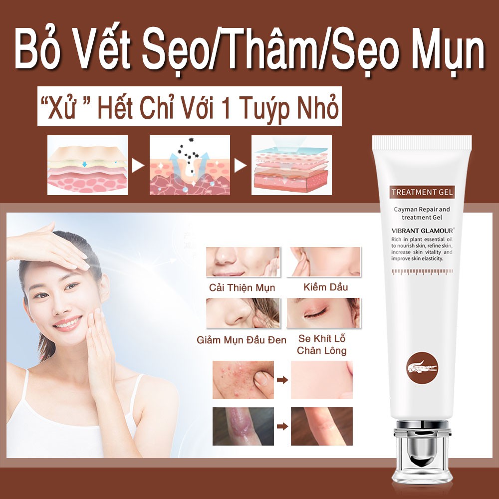 [Có Hàng Sẵn] Kem Hỗ Trợ Giảm Mụn Mờ Sẹo Làm Trắng Phục Hồi Da VIBRANT GLAMOUR Chiết Xuất Peptide Cá Sấu 30g