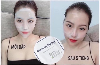 Mặt nạ Derm-all Matrix