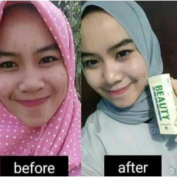 11.11|R-1262||Xịt Vẻ Đẹp Tự Nhiên 100% Nguyên Bản | BigBuy360 - bigbuy360.vn