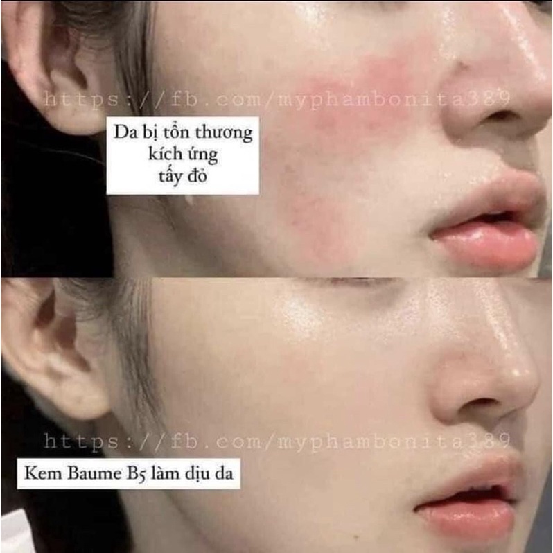 Kem dưỡng phục hồi da B5 La Roche Posay- Săn sale, đủ Bill