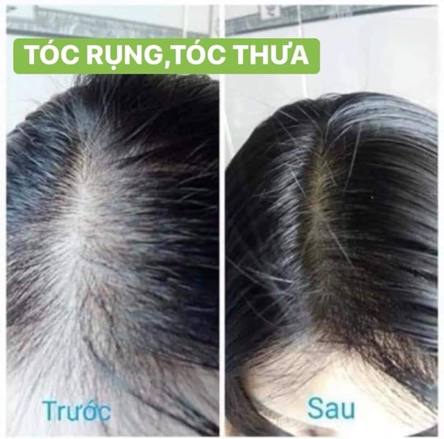 [10 chai 190k ] Tinh dầu gội thảo mộc | BigBuy360 - bigbuy360.vn