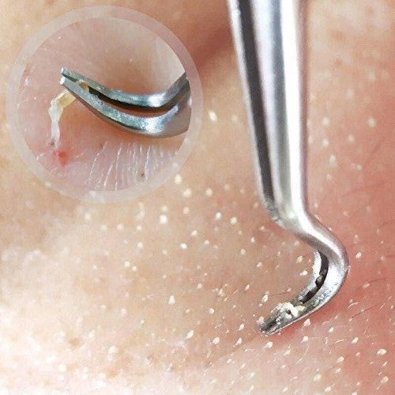 Nhíp Gắp Mụn Đầu Cong Thép Không Gỉ Nhíp Cong Lấy Nặn Mụn Đầu Đen Mụn Ẩn Nhíp Gắp Mi Nối Mi Nối Tóc Dễ Dàng