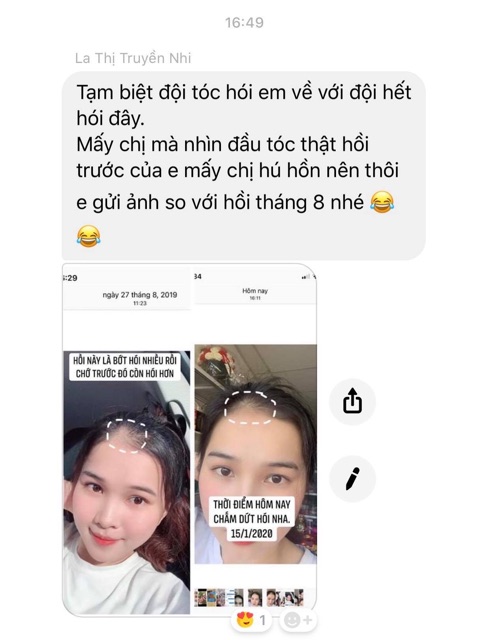 Tinh dầu bưởi Vijully giảm rụng tóc, kích tóc mọc nhanh | BigBuy360 - bigbuy360.vn
