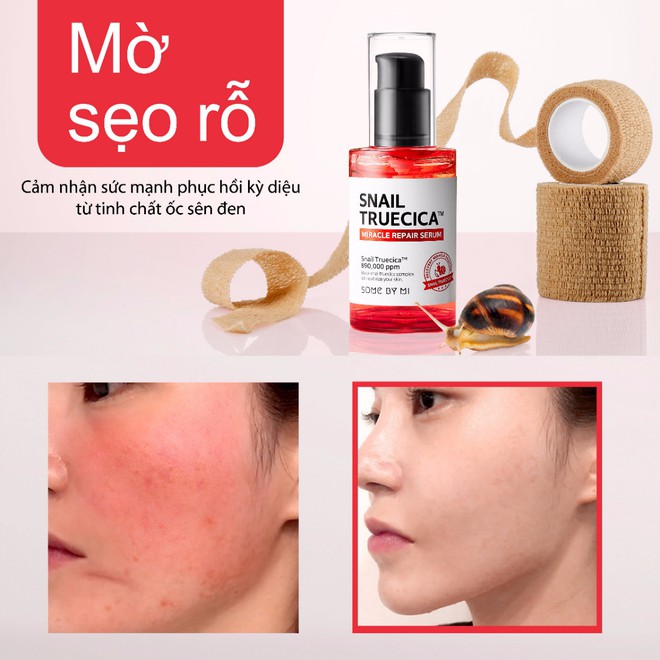 Tinh chất ốc sên Some By Mi Snail Truecica Miracle Repair Serum 50ml