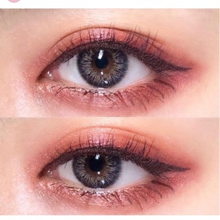 Contact lens dành cho mắt nhạy cảm