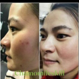 Kem tái tạo Chamomileskill