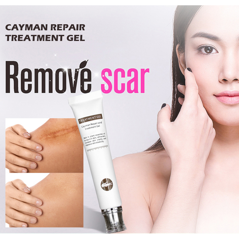 [Hàng mới về] Kem thoa hỗ trợ giảm sẹo không gây kích ứng cho da mặt và cơ thể | BigBuy360 - bigbuy360.vn