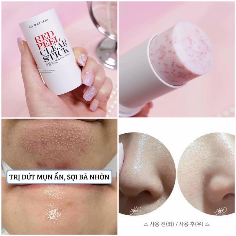 Combo Dưỡng Da Thanh Lăn Đầu Đen Clear Stick + Mặt Nạ Red Mask Của So Natural 23g và 70ml