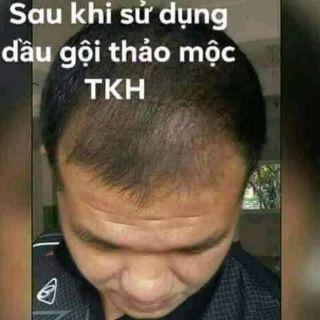 Dầu gội Trần Kim Huyền