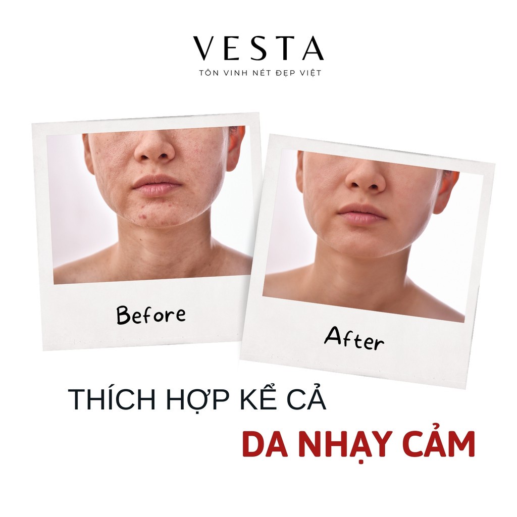 Mặt nạ nhau thai cừu nhật mask giấy rwine dưỡng da dưỡng ẩm 40ml - H.Perfumeshop