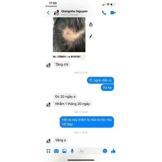 SupHerb Multi Hair Vitamin kích thích mọc tóc Do Thái