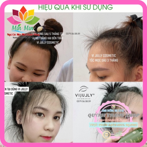 Xịt bưởi Vijully, Tinh dầu bưởi hair lotion Vijully 100ml kích mọc tóc ,giảm rụng tóc, Kèm vòi xịt