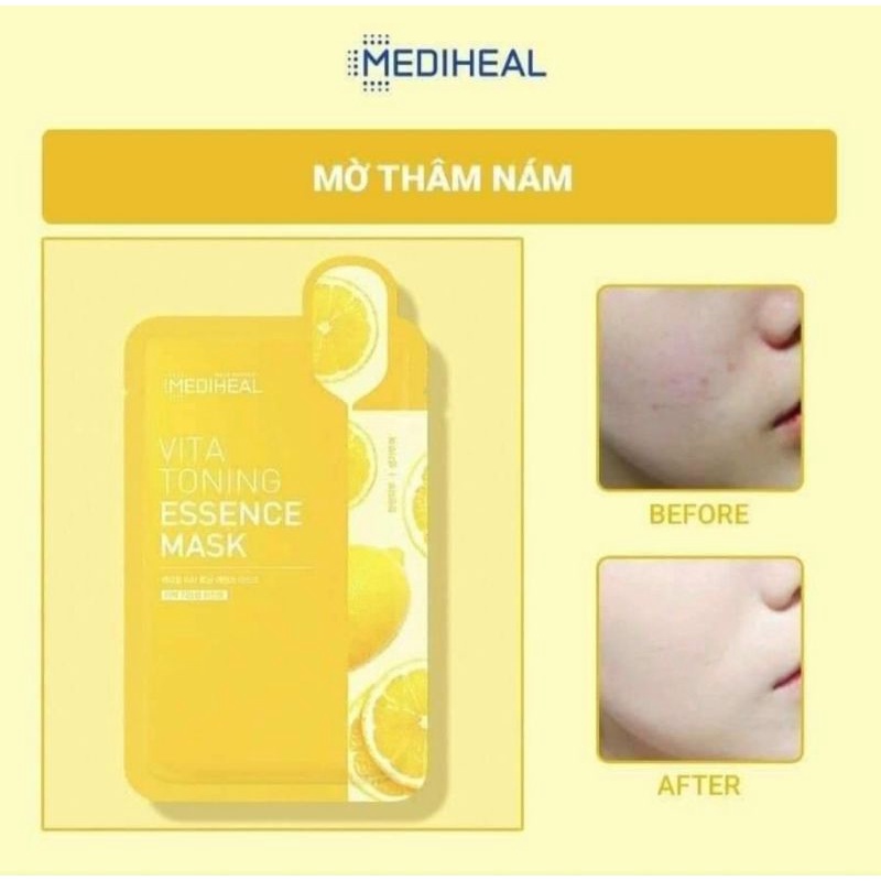 Sẵn Mặt Nạ Giấy Mediheal