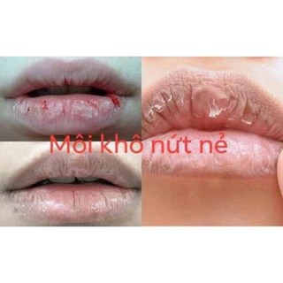 Ủ MÔI LANEIGE