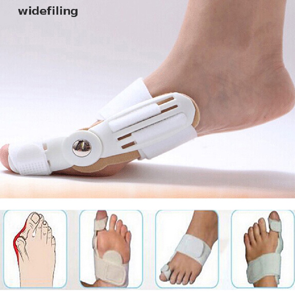 Dụng Cụ Nẹp Chỉnh Hình Ngón Chân Cái Tiện Dụng<br>