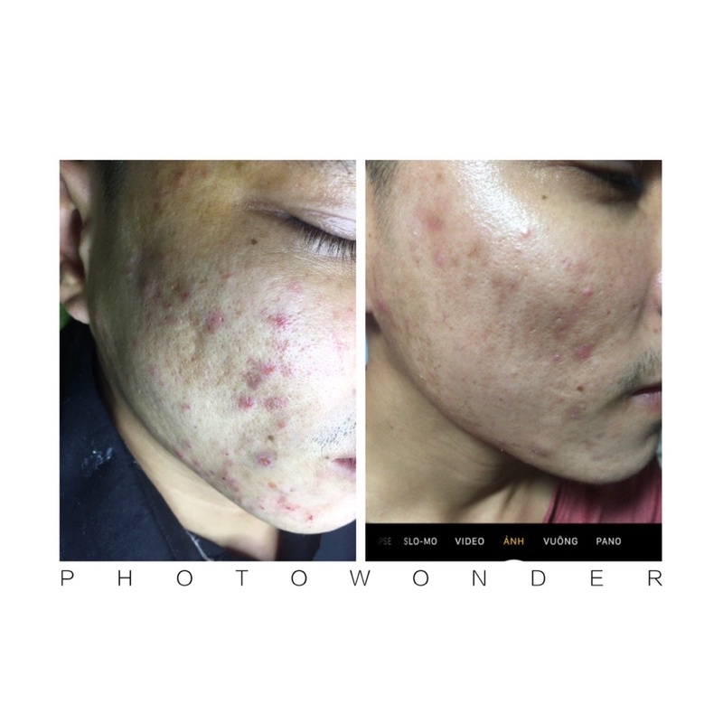 Bộ kem tái tạo da 210