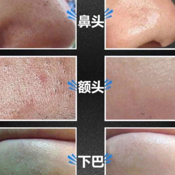 [ SIÊU HOT ] Gel lột mụn đầu đen và bã nhờn siêu sạch Bioaqua Activated Carbon Chính Hãng Dạng Gói | BigBuy360 - bigbuy360.vn