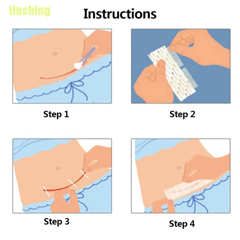 (Hàng Mới Về) 1 Dụng Cụ Y Tế Cầm Tay