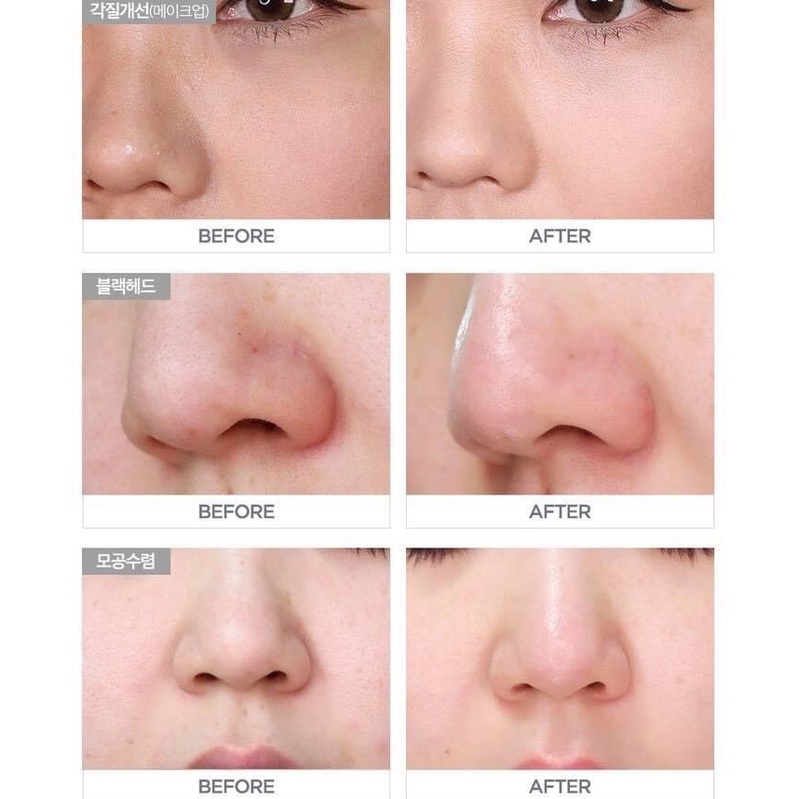 Tinh chất cho da mụn Klavuu Green Pearlsation PHA Calming Serum 120ML