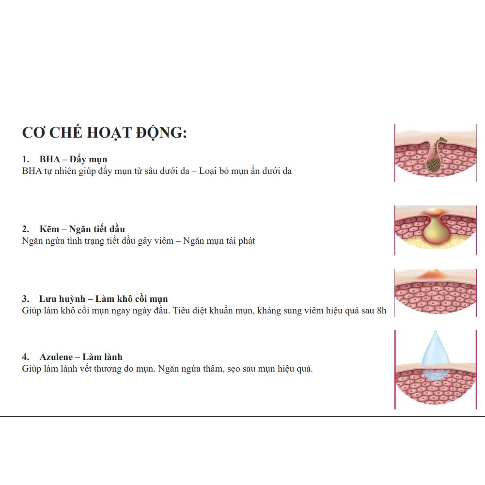 Kem giảm mụn, ngừa thâm do mụn, sáng da Nhật Kim Anh- Acnes Spot treatment Laura Sunshine