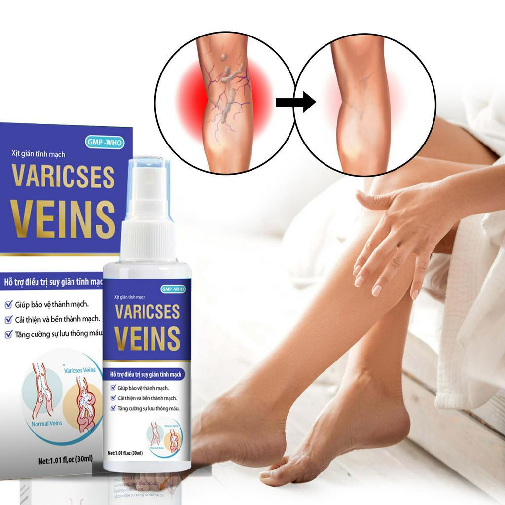 Xịt Giãn Tĩnh Mạch VARICSES VEINS