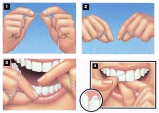 CHỈ NHA KHOA ORAL-B