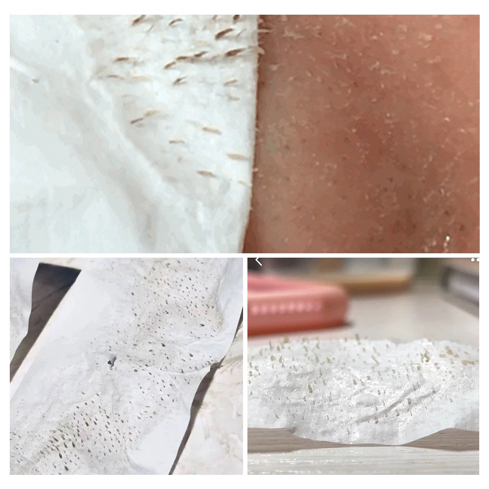 Mặt Nạ Lột Mụn Đầu Đen Breylee Giúp Se Khít Lỗ Chân Lông