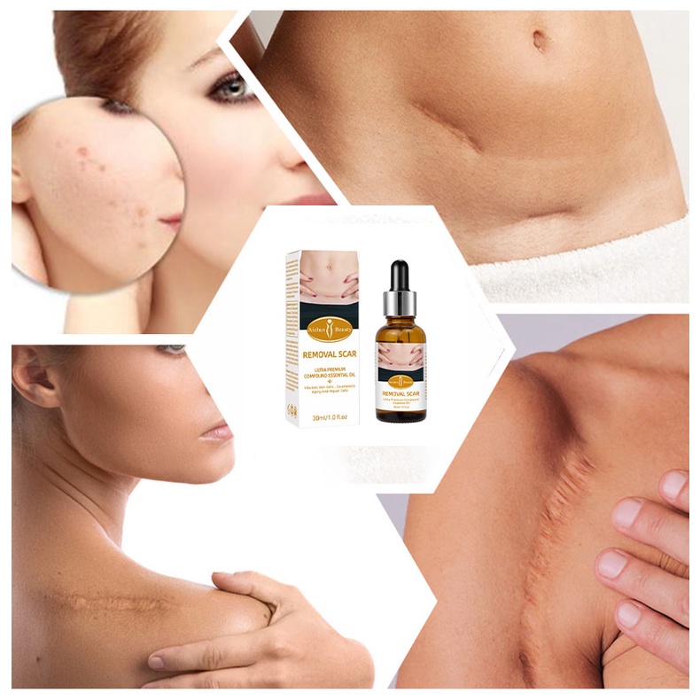 Tinh Chất Loại Bỏ Sẹo, Sẹo Thâm Do Phẫu Thuật, Seo Thâm Do Mụn Removal Scar Ultra Premium Compound Excellent Oil 30G