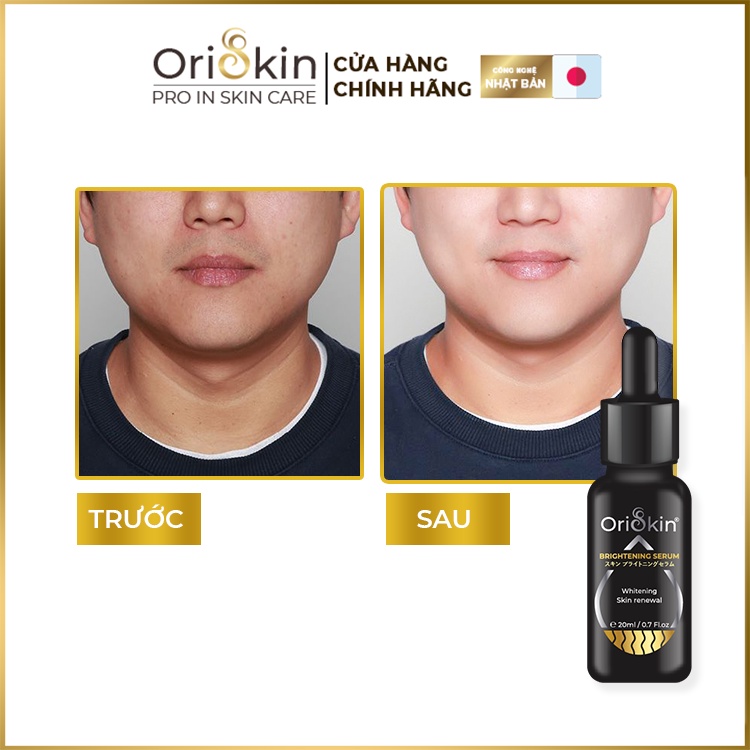 Serum Dưỡng Trắng , Giảm Nám, Tàn Nhang , Se Khit Lỗ Chân Lông , Mờ Các Vết Thâm Oriskin Brightening Serum 20 ml