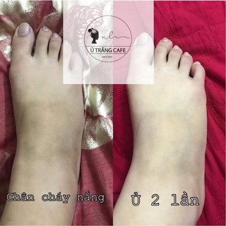 combo 10 ủ trắng