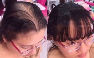 Tóc mái thưa cột❤️freeship 50k🎁 tóc che hói cao cấp 3D- hình thật