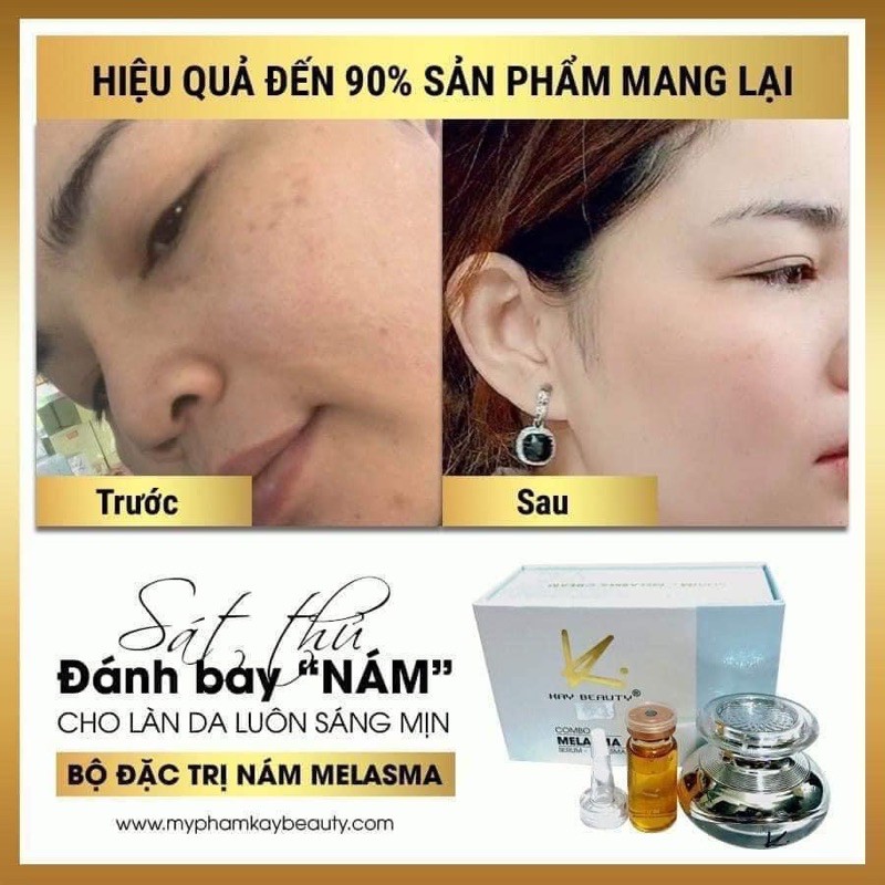 Bộ NÁM KAY BEAUTY (chính hãng)