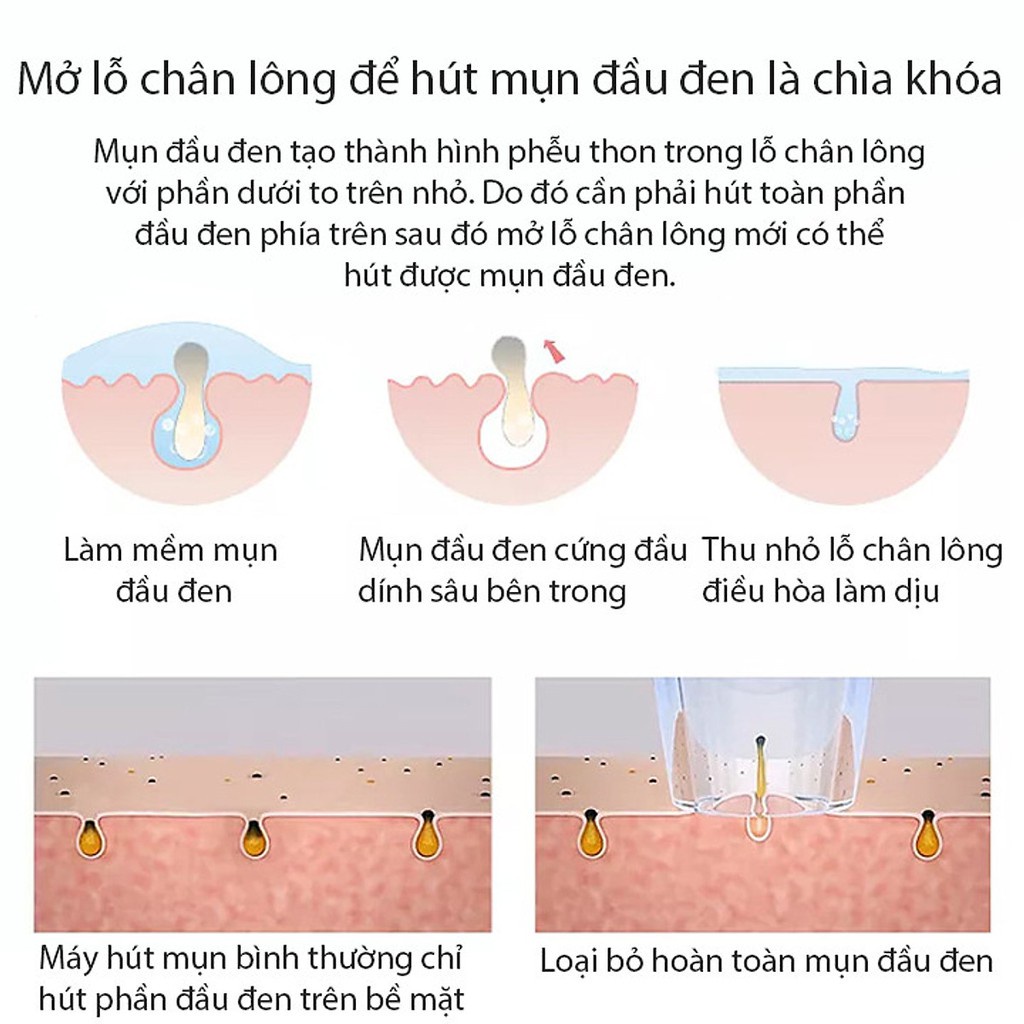 Máy Hút Mụn Cầm Tay Chính Hãng Hút Sạch Bụi Bẩn Sợi Bã Nhờn Không Gây Tổn Thương Cho Da Kotic_shop