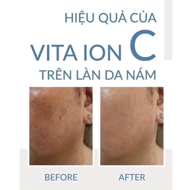 Tinh chất dưỡng sáng da và chống lão hóa da UsoLab Vita Ion C