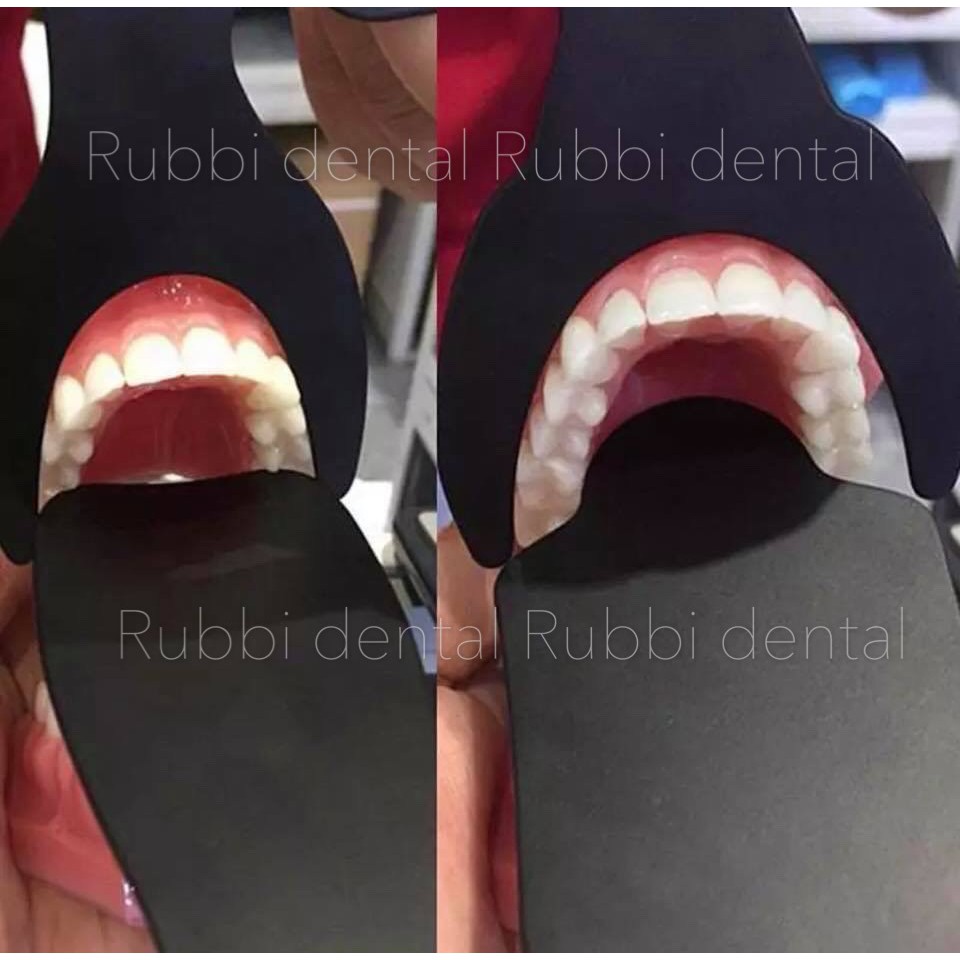 Dụng cụ chụp ảnh răng dùng trong nha khoa