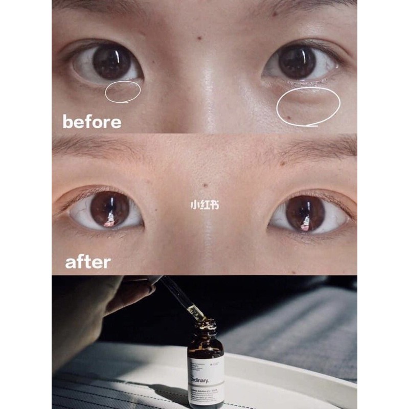 The Ordinary Caffeine Solution 5% + EGCG 30ml, Serum dưỡng ngừa thâm bọng mắt