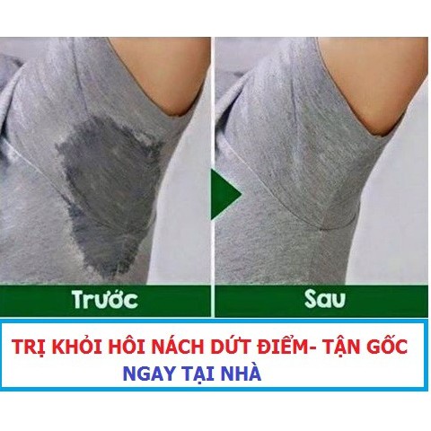 [KHUYẾN MÃI ] Bộ 4 Hộp Thảo Mộc Trị Hôi Nách Vĩnh Viễn Tận Gốc Tại Nhà + Tặng Kèm 01 Hộp Gel Lột Mụn Cám, Mụn Đầu Đen