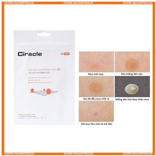 Miếng Dán Hỗ Trợ Đánh Bay Mụn Ciracle Red Spot Acne Pimple Path 24 Miếng Hàn Quốc