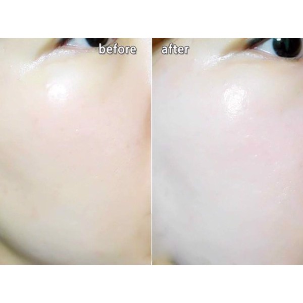 Sữa Rửa Mặt Rau Má SeoulRose Rosa Skincure Centella Cleansing Foam