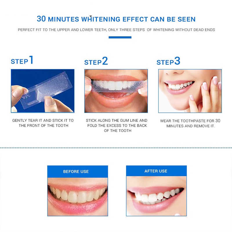 Miếng Dán Làm Rrắng Răng, Miếng Dán Làm trắng răng an toàn, dễ sử dụng, Gel trắng 5D ,7 miếng