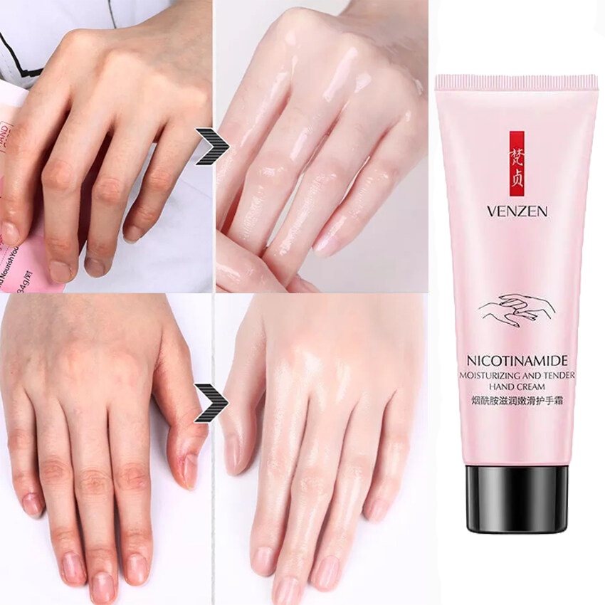 Kem dưỡng da tay Làm trắng xóa nếp nhăn nuôi dưỡng da dưỡng ẩm không nhờn dính dễ tán Hấp thụ nhanh xóa nếp nhăn