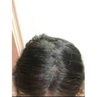 Bột phủ dày tóc hói tóc thưa Toppik + Tặng lược