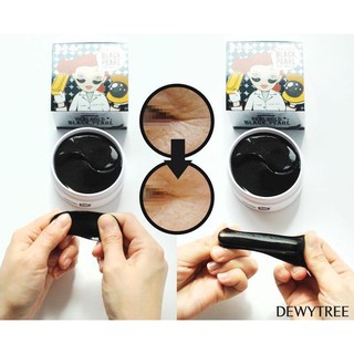 Mặt Nạ Mắt Dewy Tree Real Gold Black Pearl Eye Patch