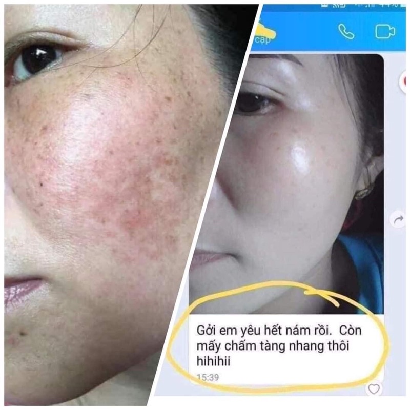 KEM TÁI TẠO DA ĐÔNG Y | BigBuy360 - bigbuy360.vn