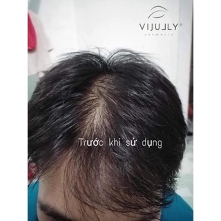 Dầu gội vijully-chính hãng