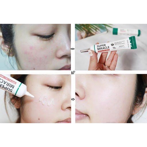 Some By Mi Super Miracle Spot All Kill Cream