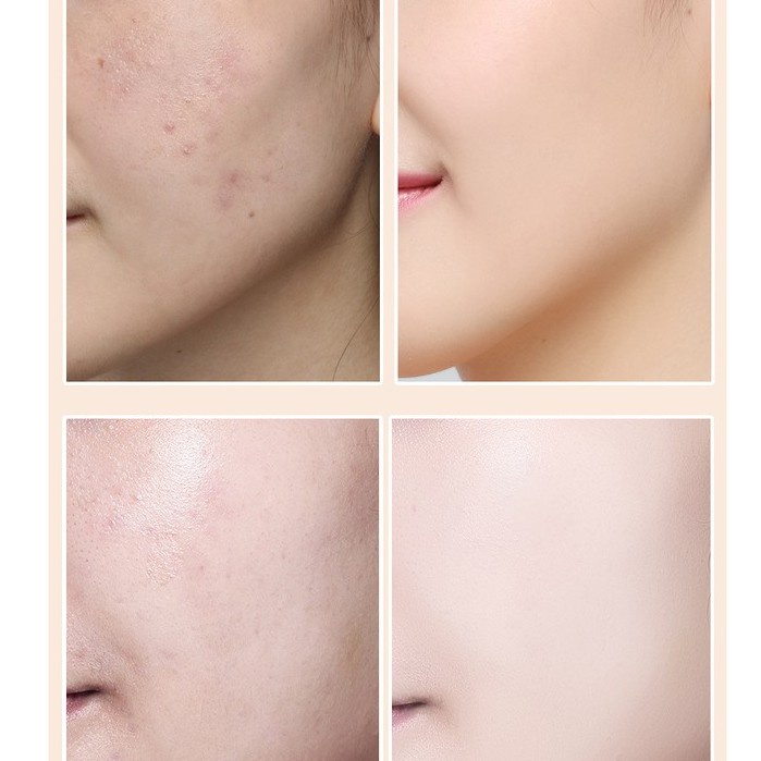Lameila Kem Nền BB Dạng Lỏng Dưỡng Ẩm Che Khuyết Điểm 30ml Thoáng Khí